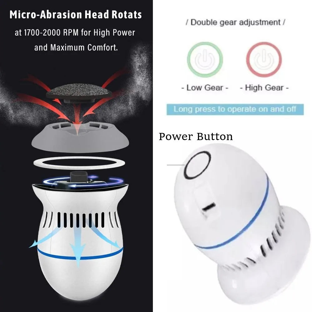 Elektrisk Fotvårdsmaskin För Mjuka Fötter Med Dammsugare 1