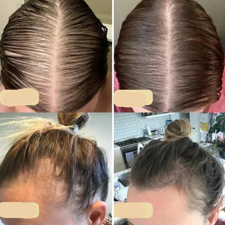 Hårväxtolja för Naturlig Hårvård 3