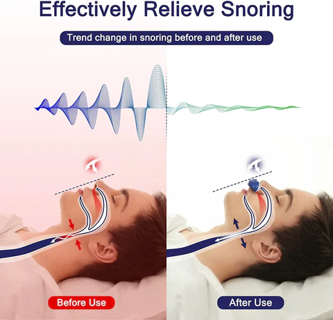 Masklös Micro CPAP-enhet för Snarkning och Resor 3